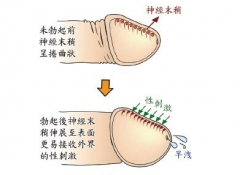 三大征兆，警惕早泄