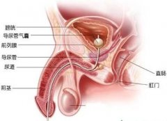 前列腺痛有哪些临床症状