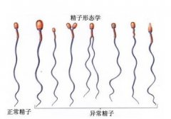怎么检查精子存活率