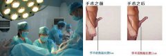 科学认识阴茎短小，科学治疗